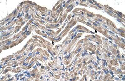 Immunohistochemistry-Paraffin: Neuroplastin Antibody [NBP1-62423]