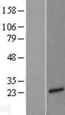 Western Blot: Neurotensin Overexpression Lysate [NBL1-13841]