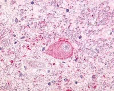 Immunohistochemistry-Paraffin: NTS1/NTSR1 Antibody - BSA Free [NLS938]