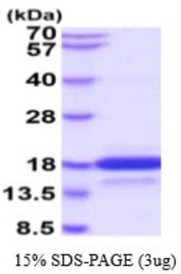 SDS-PAGE: Recombinant Human Neurotensin His Protein [NBP2-53079]