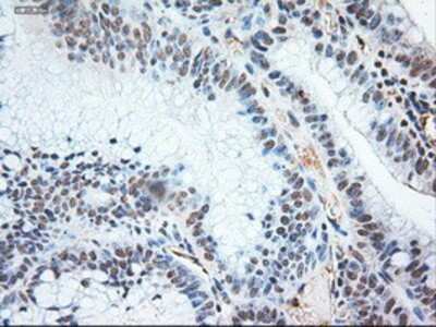 Immunohistochemistry-Paraffin: NT-3 Antibody (OTI5A2) [NBP1-47892]