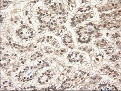 Immunohistochemistry-Paraffin: NT-3 Antibody (OTI5A2) [NBP1-47892]