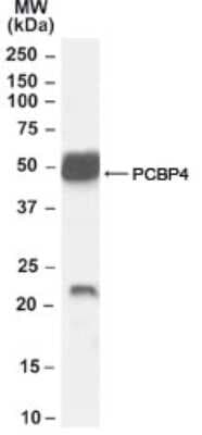 Western Blot: Neurturin Antibody [NB100-68153]