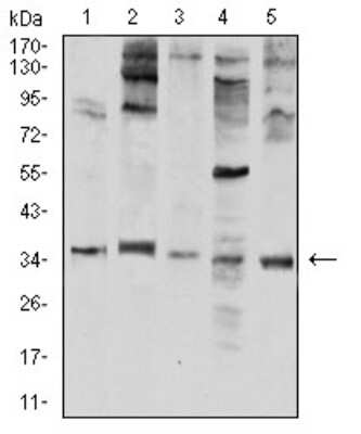Western Blot: Neutrophil Elastase/ELA2 Antibody (6B6G6)BSA Free [NBP2-61657]