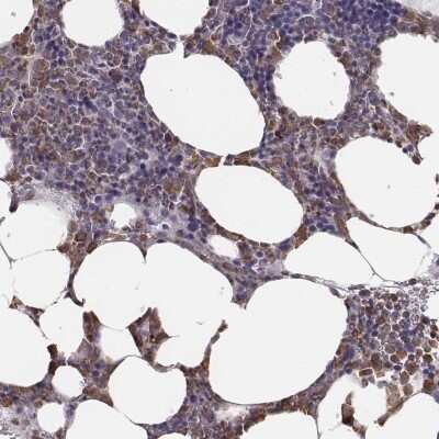 Immunohistochemistry-Paraffin: Neutrophil Elastase/ELA2 Antibody [NBP2-57576]