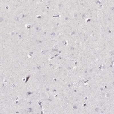 Immunohistochemistry-Paraffin: Neutrophil Elastase/ELA2 Antibody [NBP2-57576]