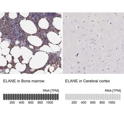 Immunohistochemistry-Paraffin: Neutrophil Elastase/ELA2 Antibody [NBP2-57576]