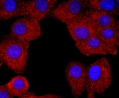 Immunocytochemistry/ Immunofluorescence: Neutrophil Elastase/ELA2 Antibody (JF098-6) [NBP2-66972]