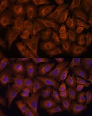 Immunocytochemistry/ Immunofluorescence: Nexilin Antibody - Azide and BSA Free [NBP2-93780]
