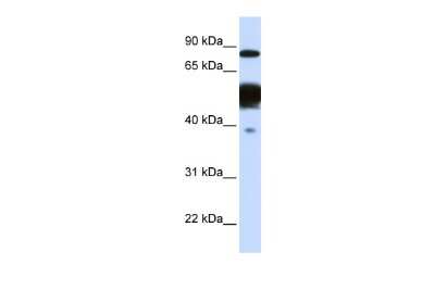 Western Blot: Nexilin Antibody [NBP1-53226]