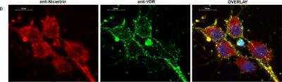 Immunocytochemistry/ Immunofluorescence: Nicastrin Antibody - BSA Free [NBP1-77269]