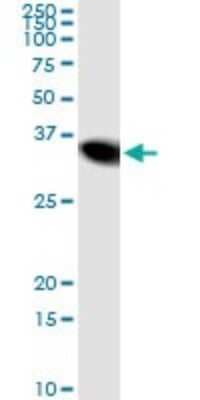 Immunoprecipitation: Nicotinamide N-Methyltransferase/NNMT Antibody (2F2) [H00004837-M03]