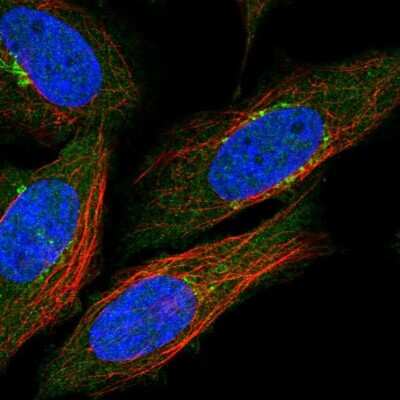 Immunocytochemistry/ Immunofluorescence: Nicotinamide N-Methyltransferase/NNMT Antibody [NBP2-32438]