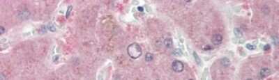 Immunohistochemistry: Nicotinamide N-Methyltransferase/NNMT Antibody [NBP1-55398]