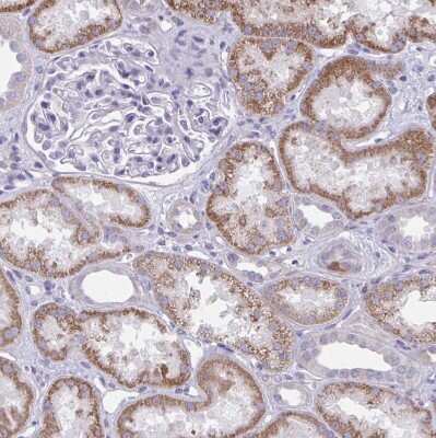 Immunohistochemistry-Paraffin: Nicotinamide N-Methyltransferase/NNMT Antibody [NBP2-32438]