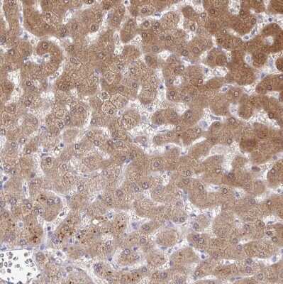 Immunohistochemistry-Paraffin: Nicotinamide N-Methyltransferase/NNMT Antibody [NBP2-32438]