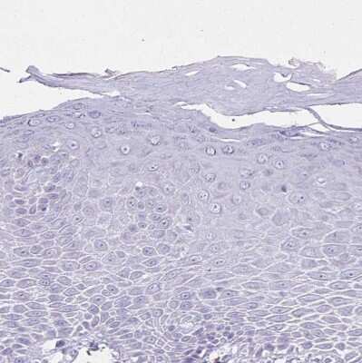 Immunohistochemistry-Paraffin: Nicotinamide N-Methyltransferase/NNMT Antibody [NBP2-32438]