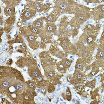 Immunohistochemistry-Paraffin: Nicotinamide N-Methyltransferase/NNMT Antibody - Azide and BSA Free [NBP3-03406]