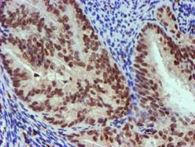 Immunohistochemistry: Nicotinamide N-Methyltransferase/NNMT Antibody (OTI3D8) - Azide and BSA Free [NBP2-72984]