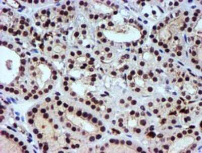 Immunohistochemistry: Nicotinamide N-Methyltransferase/NNMT Antibody (OTI3D8) - Azide and BSA Free [NBP2-72984]