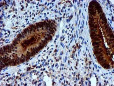 Immunohistochemistry: Nicotinamide N-Methyltransferase/NNMT Antibody (OTI3D8) - Azide and BSA Free [NBP2-72984]
