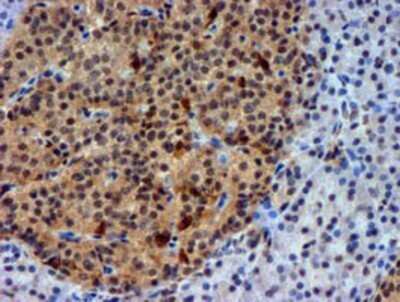 Immunohistochemistry: Nicotinamide N-Methyltransferase/NNMT Antibody (OTI3D8) - Azide and BSA Free [NBP2-72984]