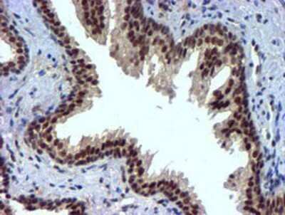Immunohistochemistry: Nicotinamide N-Methyltransferase/NNMT Antibody (OTI3D8) - Azide and BSA Free [NBP2-72984]