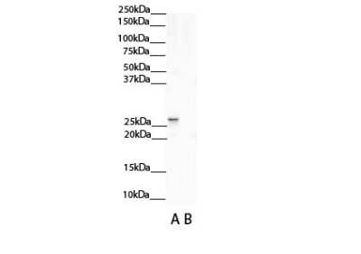 Western Blot: Nicotinamide N-Methyltransferase/NNMT Antibody [NBP1-55398]