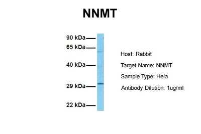 Western Blot: Nicotinamide N-Methyltransferase/NNMT Antibody [NBP1-55398]