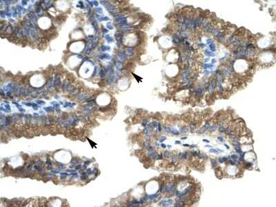 Immunohistochemistry: Nicotinic Acetylcholine R alpha 1/CHRNA1 Antibody [NBP2-85380]
