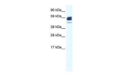 Western Blot: Nicotinic Acetylcholine R alpha 1/CHRNA1 Antibody [NBP2-85379]