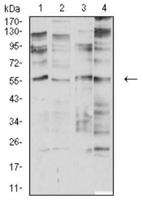 Western Blot: Nicotinic Acetylcholine R alpha 2/CHRNA2 Antibody (7G12H9)BSA Free [NBP2-61667]