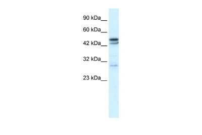 Western Blot: Nicotinic Acetylcholine R alpha 3/CHRNA3 Antibody [NBP2-87918]