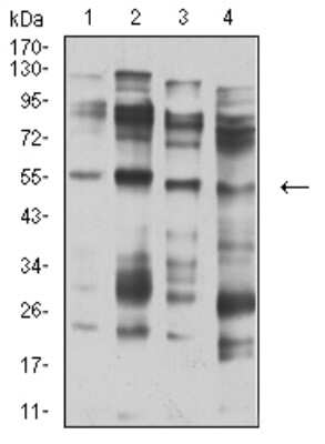 Western Blot: Nicotinic Acetylcholine R alpha 5/CHRNA5 Antibody (2D2D10)BSA Free [NBP2-61677]