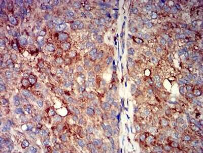 Immunohistochemistry-Paraffin: Nicotinic Acetylcholine R alpha 7/CHRNA7 Antibody (7F10G1) - BSA Free [NBP2-61739]