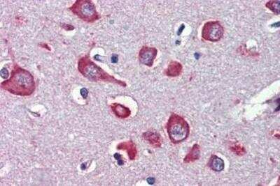 Immunohistochemistry-Paraffin: Nicotinic Acetylcholine R alpha 7/CHRNA7 Antibody [NBP1-52375]