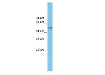 Western Blot: Nicotinic Acetylcholine R alpha 7/CHRNA7 Antibody [NBP1-79948]