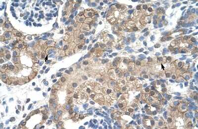 Immunohistochemistry: Nicotinic Acetylcholine Receptor beta 2 Antibody [NBP2-82288]
