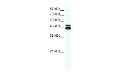 Western Blot: Nicotinic Acetylcholine Receptor beta 2 Antibody [NBP2-82290]