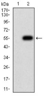 Western Blot: Nicotinic Acetylcholine Receptor beta 4 Antibody (7F5B2)BSA Free [NBP2-61742]
