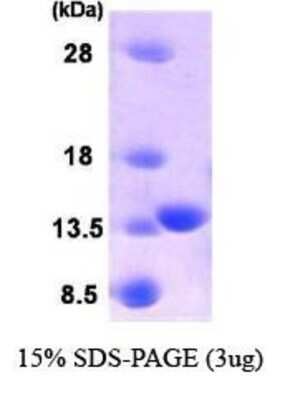SDS-PAGE: Recombinant Human PLA2G16/HRASLS3 Protein [NBC1-22617]