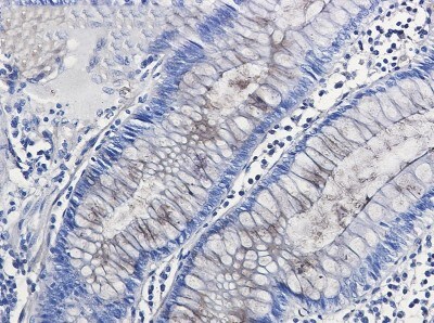 Immunohistochemistry-Paraffin: Nidogen-1/Entactin Antibody (S08-3H3) [NBP3-19860]