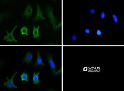 Immunocytochemistry/ Immunofluorescence: Niemann-Pick C1 Antibody - BSA Free [NB400-148]