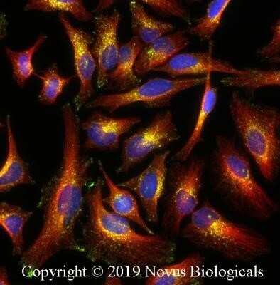 Immunocytochemistry/ Immunofluorescence: Niemann-Pick C1 Antibody (1318A) - Azide and BSA Free [NBP2-80879]
