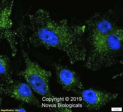 Immunocytochemistry/ Immunofluorescence: Niemann-Pick C1 Antibody (1318A) - Azide and BSA Free [NBP2-80879]
