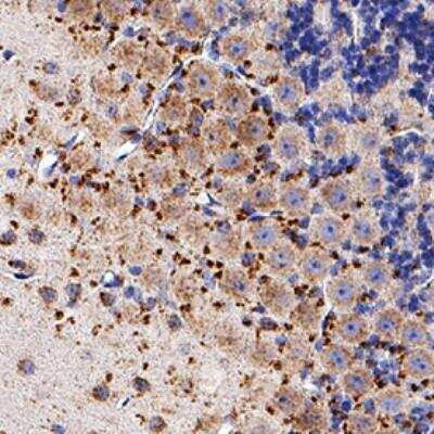 Immunohistochemistry-Paraffin: Niemann-Pick C1 Antibody (1318A) - BSA Free [NBP2-76798]