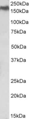 Western Blot: Niemann-Pick C1 Antibody [NBP2-26214]