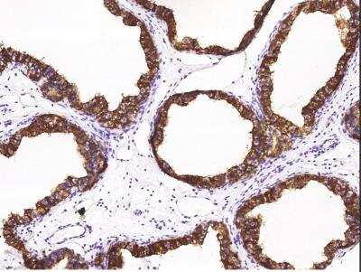Immunohistochemistry-Paraffin: Niemann-Pick type C2 Antibody (029) [NBP2-90210]