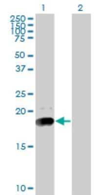 Western Blot: Niemann-Pick type C2 Antibody (4B9) [H00010577-M01]