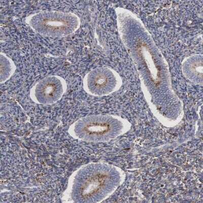Immunohistochemistry-Paraffin: Niemann-Pick type C2 Antibody [NBP1-84012]